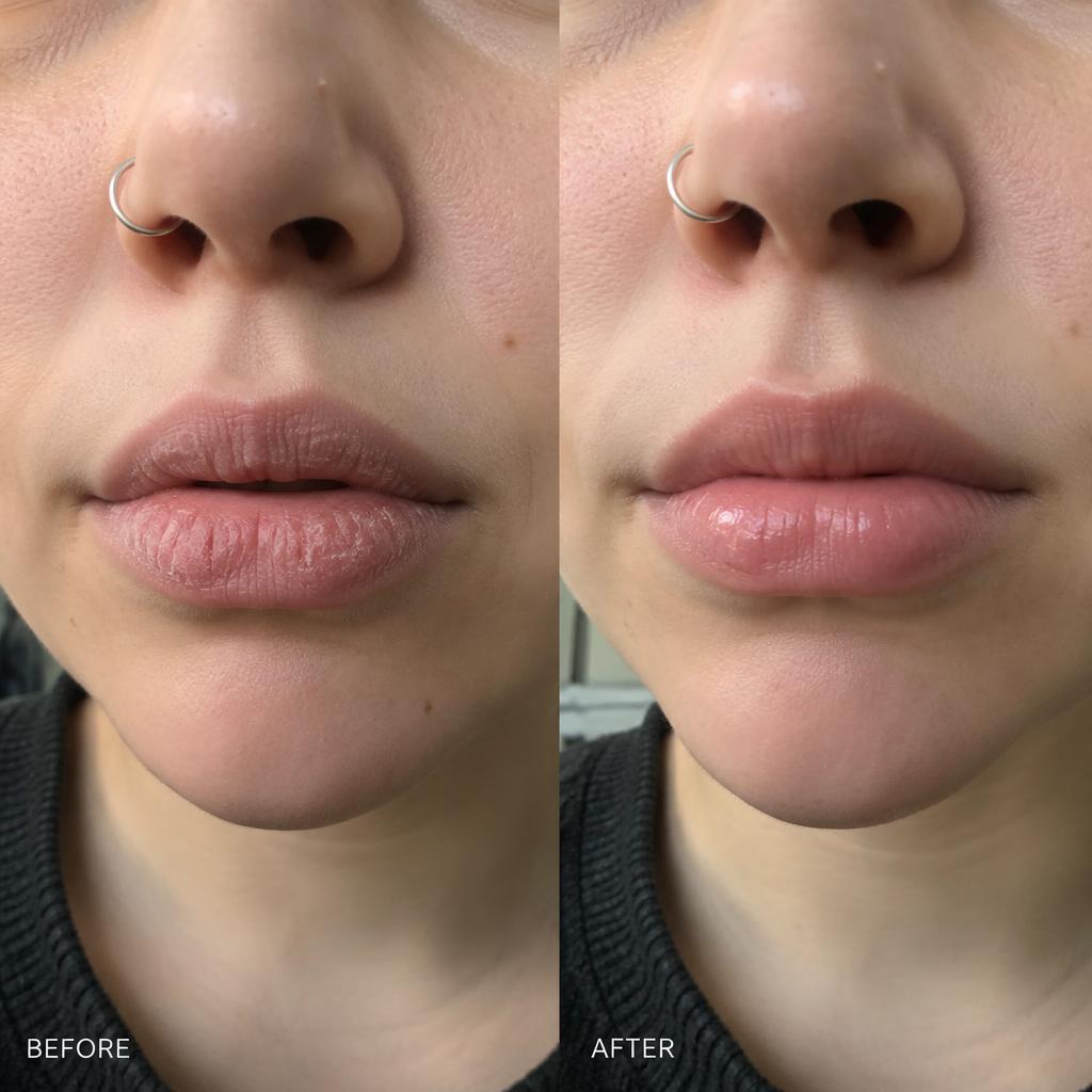 Lips before and after regular lip balm use